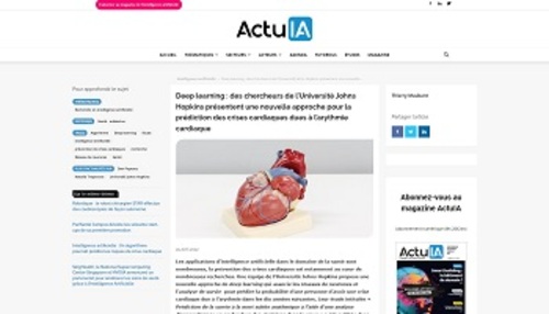 Couverture de Deep learning : des chercheurs de l'Université Johns Hopkins présentent une nouvelle approche pour la prédiction des crises cardiaques dues à l'arythmie cardiaque